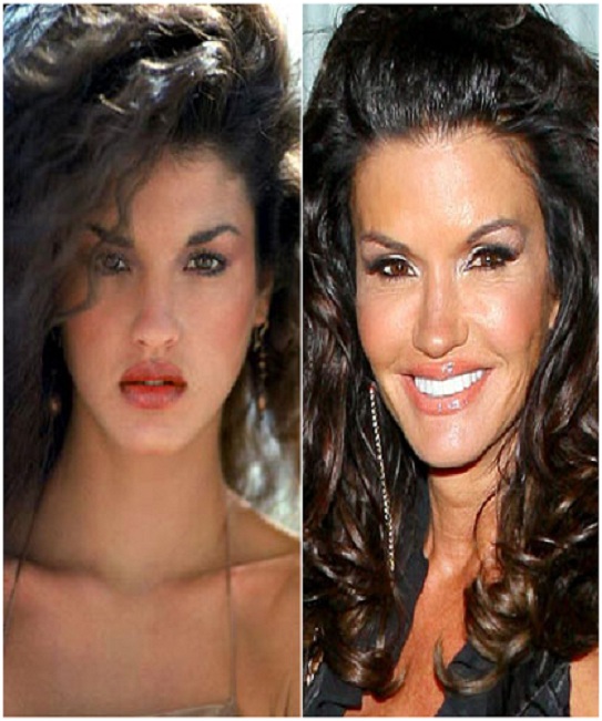 Janice Dickinson (Before & After) - Top 15 Celebs with Plastic Surgery